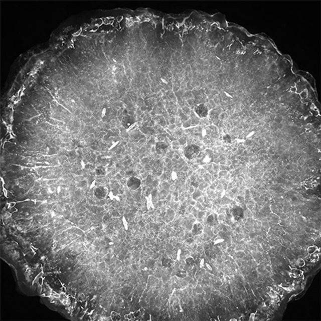 scansione del cristallo proteico